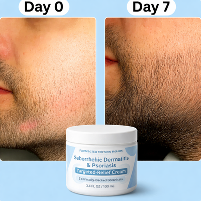 PureAura ZeroFlake Cream™